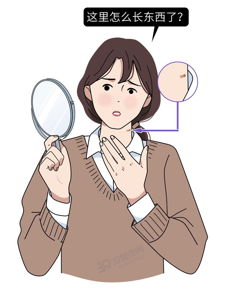 左腋下长小肉粒是hpv感染吗,腋下长了一个丝状疣一定是hpv吗