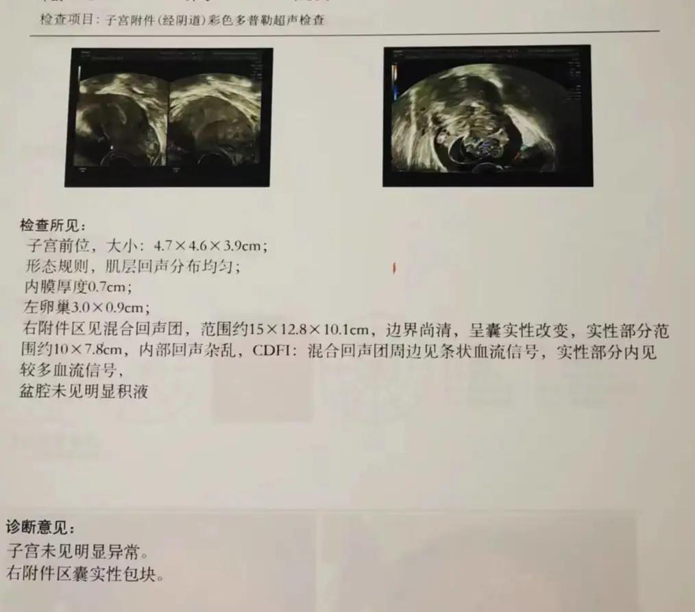 我勉强吃下一颗草莓,然后红红的草莓汁混合着胆汁一起往外翻涌