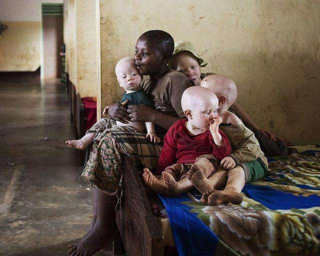 非洲版唐僧：血液堪比钻石，躯干价值126万元，警方24小时守卫