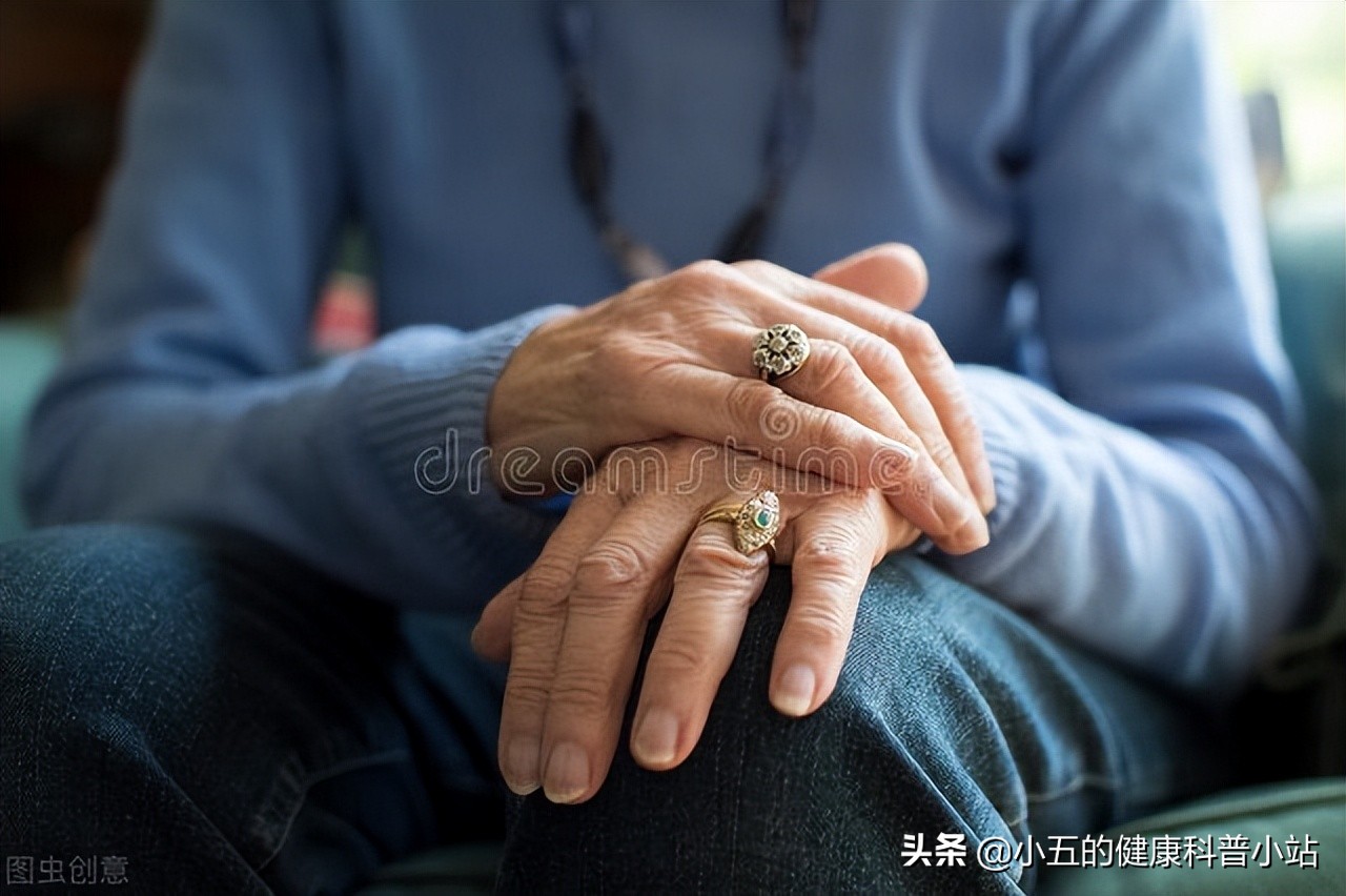 艾地苯醌治疗帕金森症状,艾地苯醌片对帕金森病有用吗