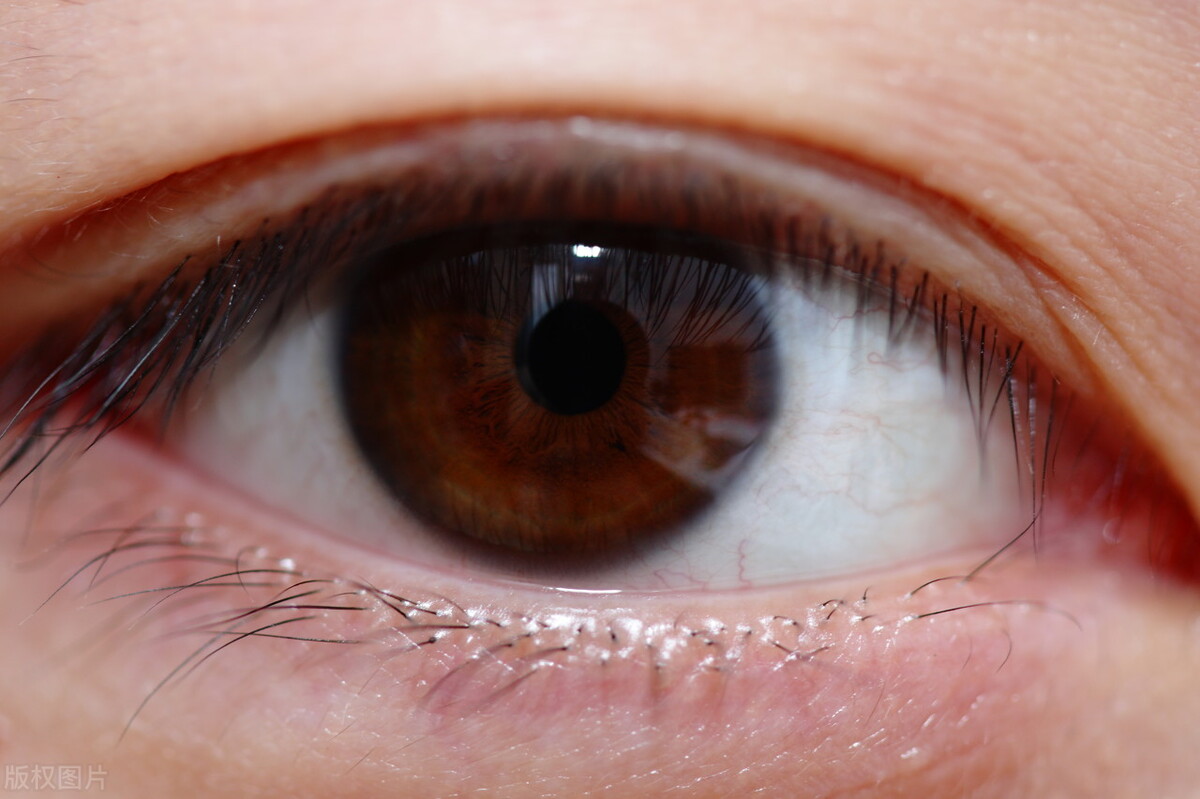 视神经萎缩老中医偏方,眼视神经萎缩怎么恢复