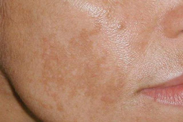 逍遥丸归脾丸加明目地黄丸,归脾丸六味地黄丸逍遥丸