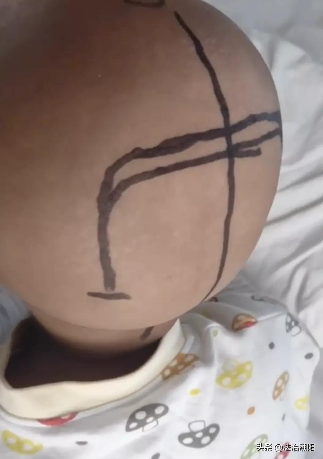 3岁儿子确诊癌症,3岁男孩确诊癌症晚期