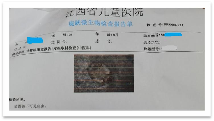 孩子全身痒痒夜间更明显怎么回事,小孩得疥疮为什么抓痒会起一个包