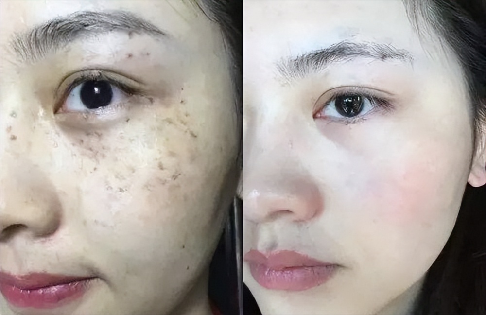 美白淡斑祛斑霜十大排名,祛斑霜效果最好的排名第一化妆品