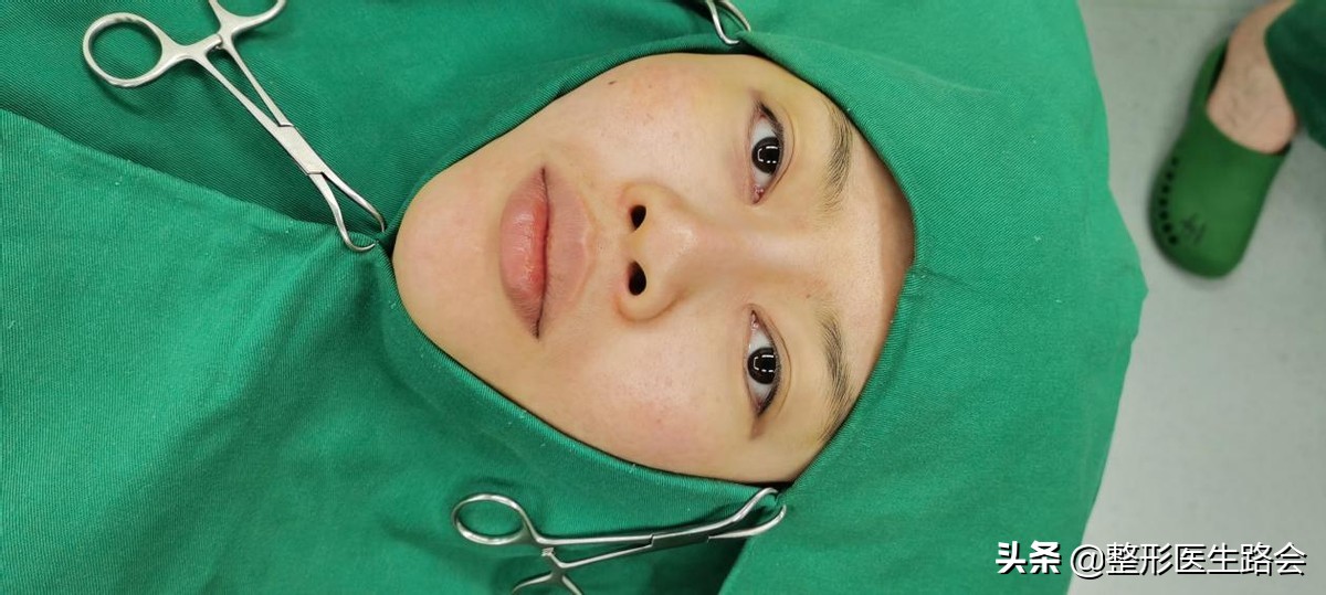 隆鼻失败鼻头有个坑的原因,隆鼻失败导致的鼻头凹陷怎么修复