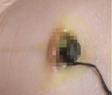 月嫂照顾产妇护理程序,新生儿养育护理常识