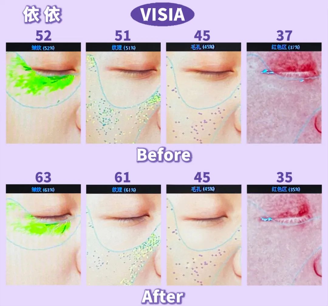美肌抗老,城野医生169抗老精华测评