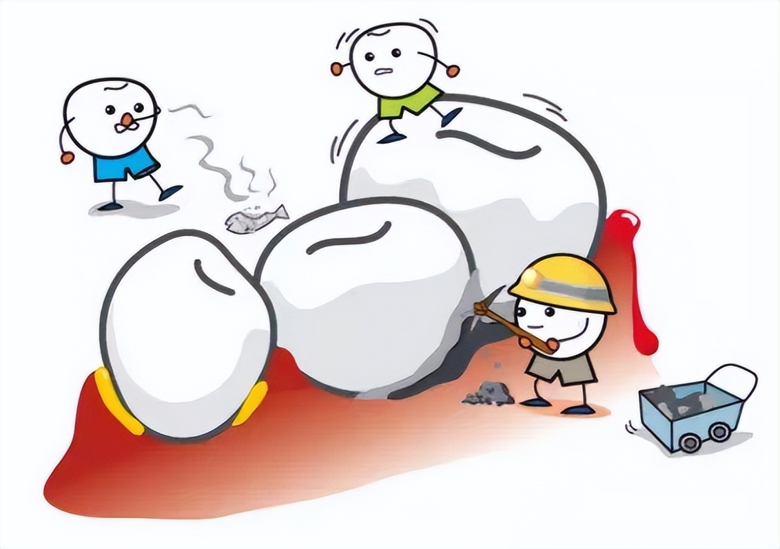 连体畸形牙齿,牙齿有重叠部分可以把牙齿磨小吗