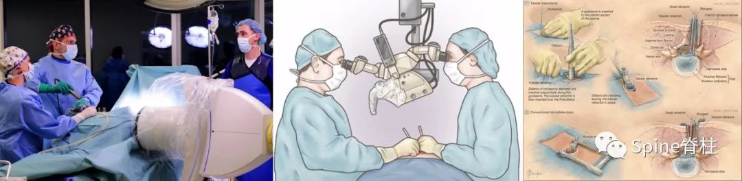 腰椎间盘突出症状表现,腰椎间盘突出症疼痛最佳止痛方法