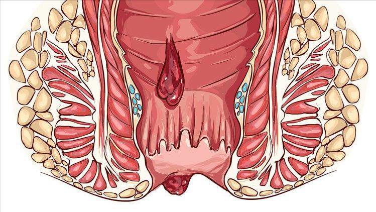 你有洗屁股的习惯吗,你有洗屁屁的习惯吗