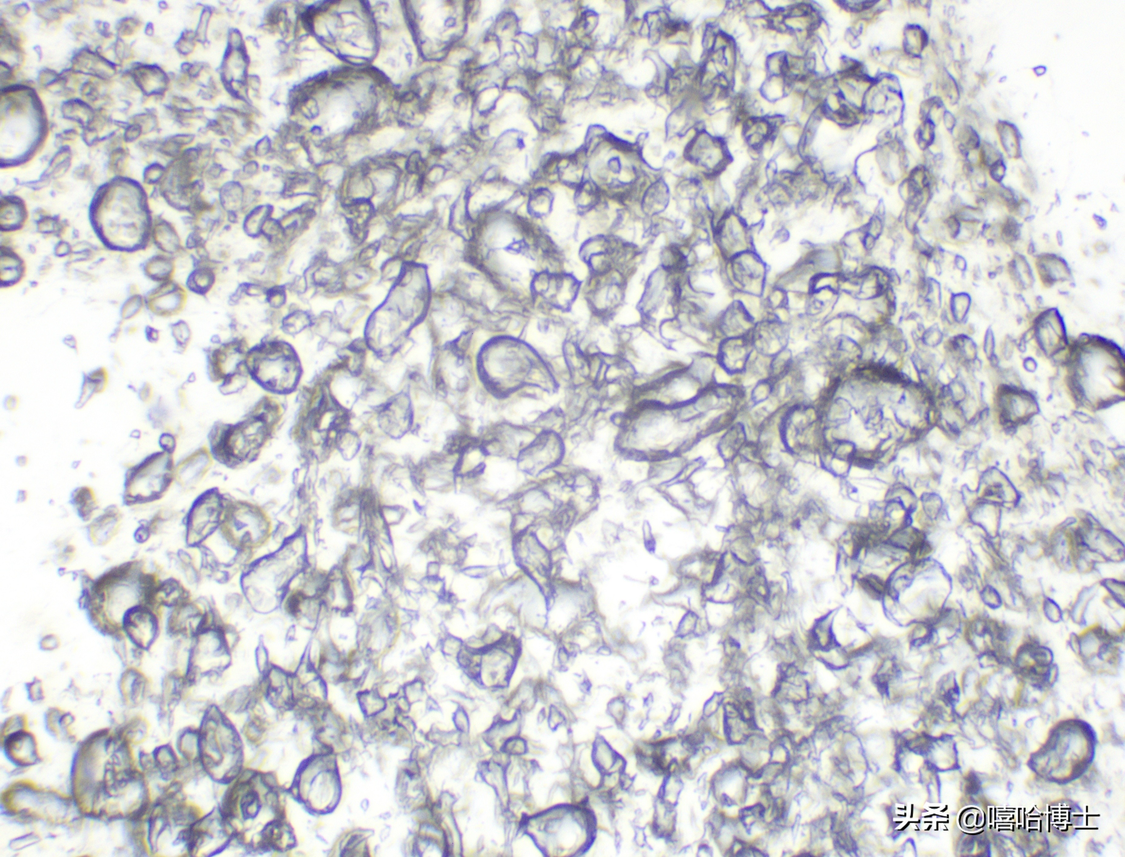 超级显微镜下的山竹,显微镜下的山竹果