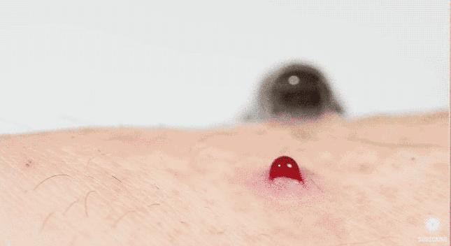 带娃出门游遇到蜱虫千万别乱拔,警惕这三种毒虫带娃出行必看