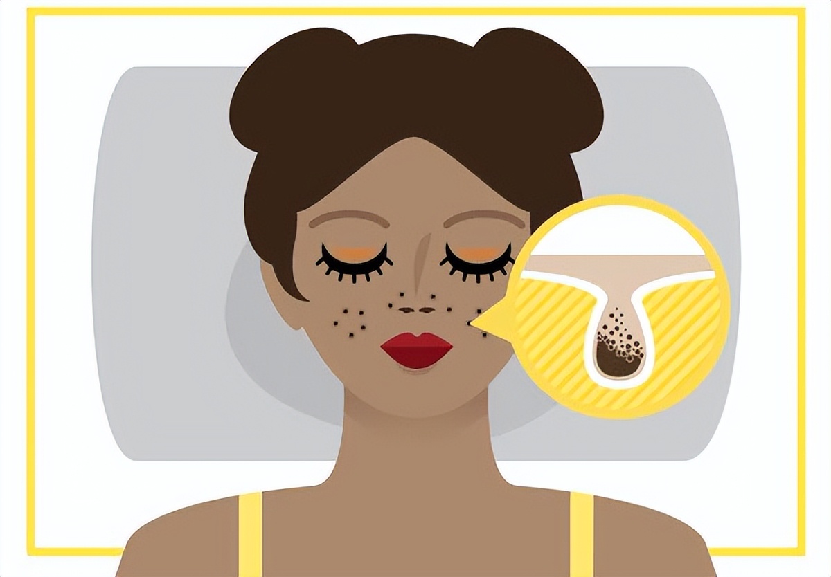 头皮毛孔堵塞怎么疏通毛孔最有效,毛孔堵塞怎么疏通最快最有效