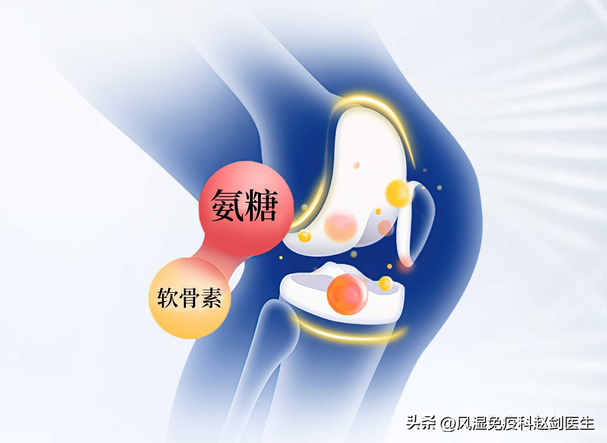 68岁膝盖疼可以补氨糖软骨素吗,退行性膝关节炎吃氨糖软骨素好吗