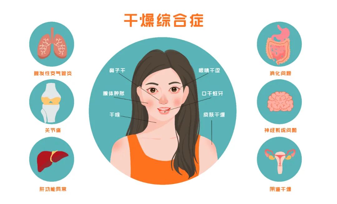 狼疮起皮疹了什么原因,狼疮患者平时皮肤会很差吗