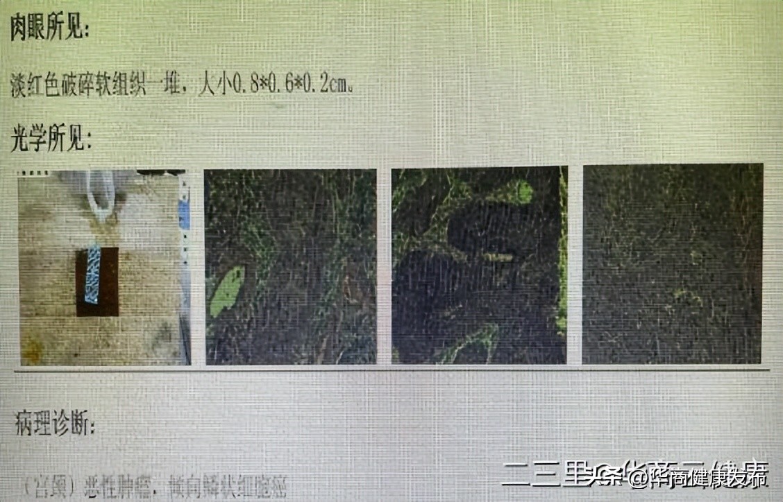 全国肿瘤宣传周癌症防治核心要点,肿瘤防治宣传周公益科普短视频