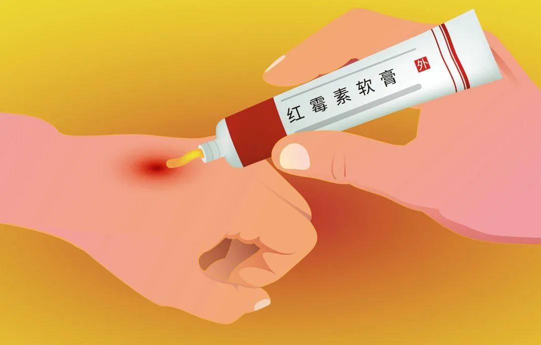 红霉素软膏万能药膏,红霉素神药