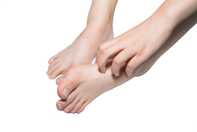 脚气一直不好还脱皮,脚气一直不好一直脱皮