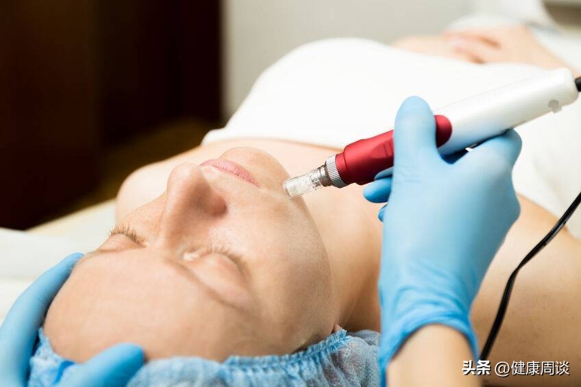 中年女性脸部的斑用什么办法去掉,人的面部色斑最常见的有哪些