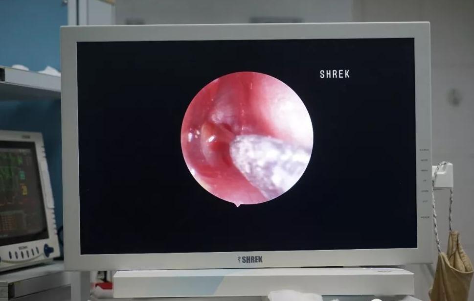 耳朵里面很痒却挠不到掏不出东西,耳朵痒掏出来的东西潮湿有臭味