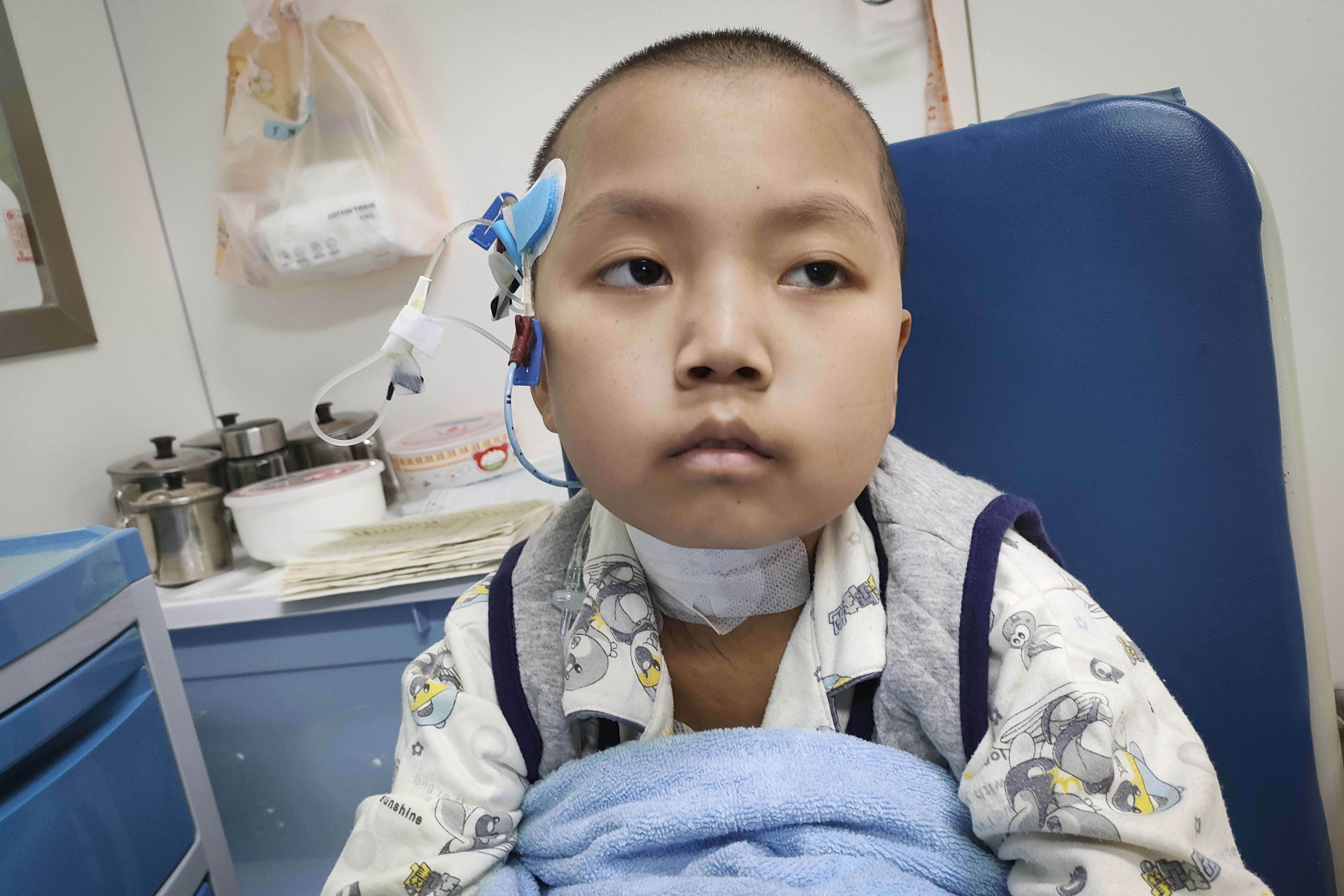 小男孩得了怪病肚子又大又圆,男孩患罕见病肚子大