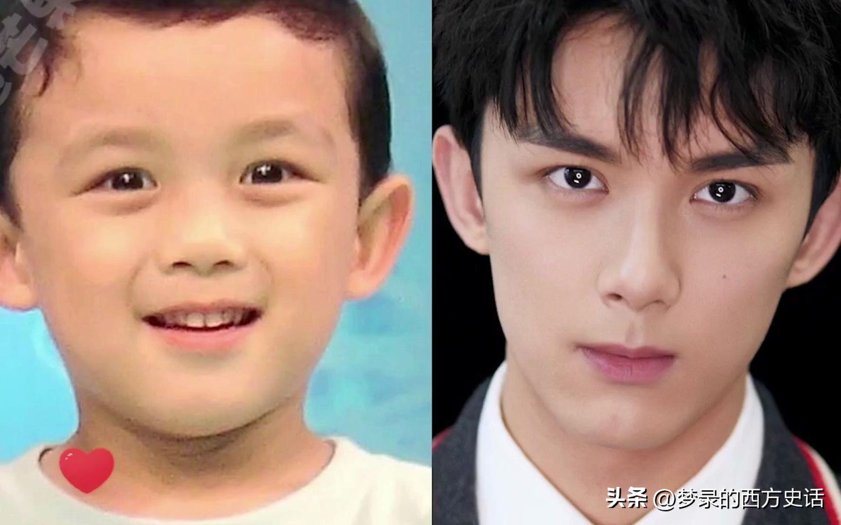 皮肤溃烂的童星,童星打促进生长激素后真实经历