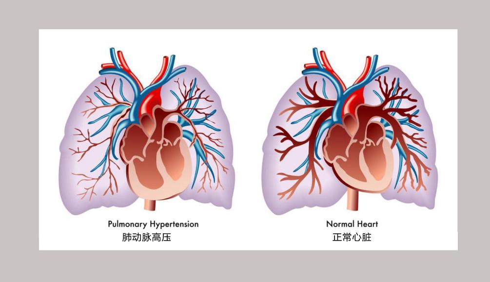 伟哥心脏的副作用停药后能恢复吗,伟哥连续吃几次停药