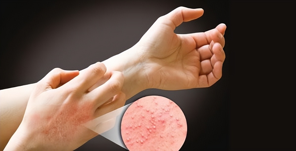 女子经常用艾叶洗头,艾叶煮水洗头副作用