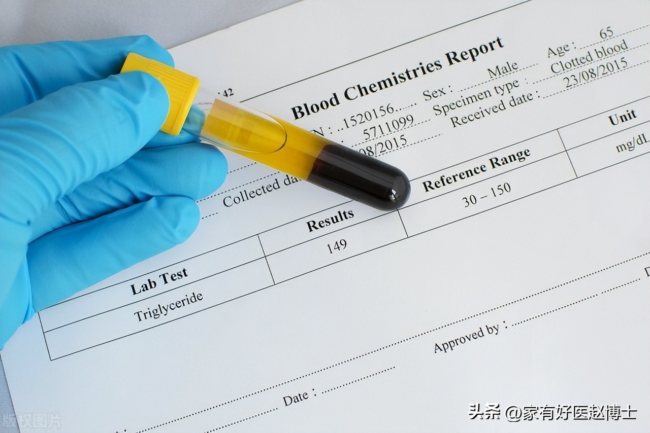 甘油三酯降到多少不用吃降脂药了,甘油三酯高到多少需要吃降血脂药
