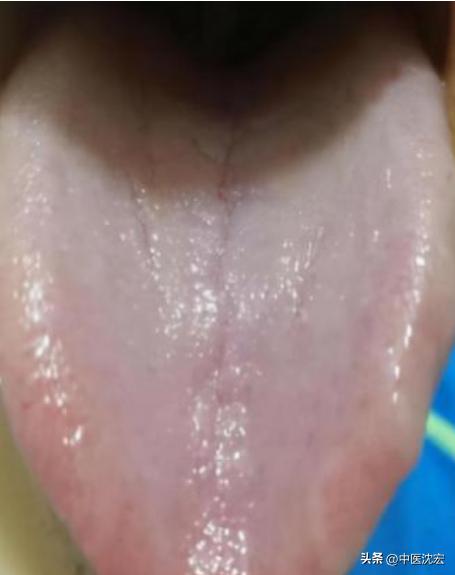 肝不好，人易倒，肝不好有这5种表现，教你5种中成药，养肝调肝