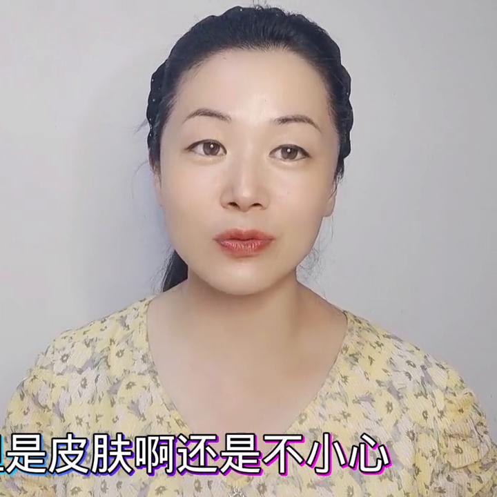 皮肤晒伤发红发痒怎么办小妙招,晒伤皮肤发红发痒怎么缓解