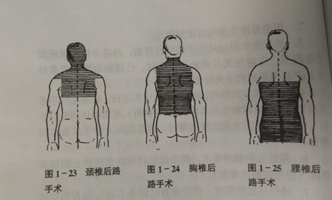 外科手术消毒、铺巾操作，做好这几个细节事半功倍