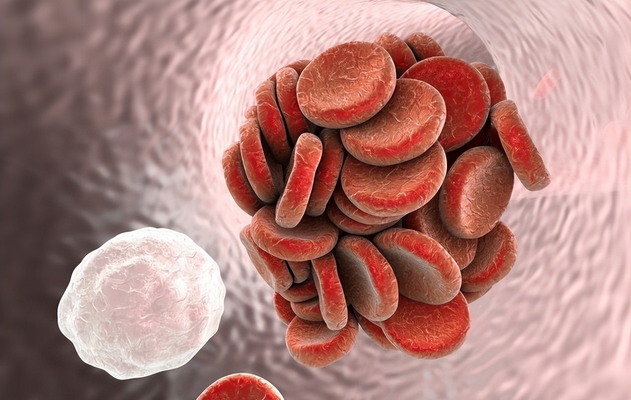 叶酸维生素c可以预防脑梗塞吗,叶酸治疗脑梗塞的最好方法