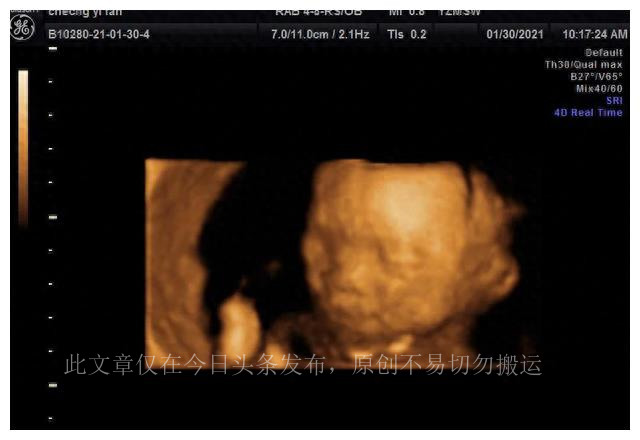 孕23周四维彩超看心脏吗,孕23周四维彩超能看到什么