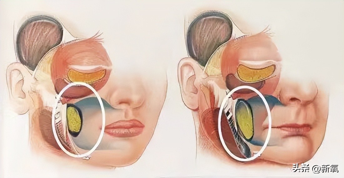 刘雯高级感,刘雯的脸型适合的风格