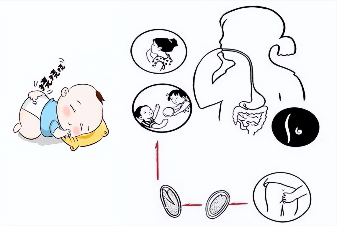 宝宝总是抠屁屁家长要警惕这种病,宝宝屁屁有蛲虫用什么