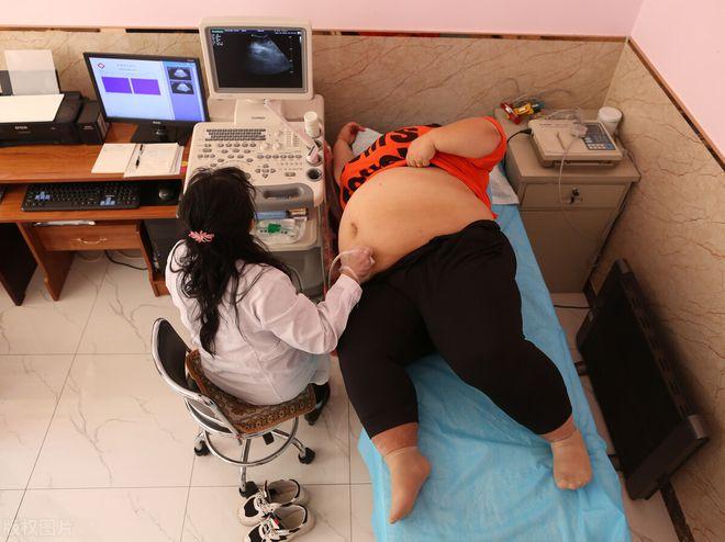 当年校花被丈夫养胖三百多斤,结婚3年校花被丈夫喂胖到332斤