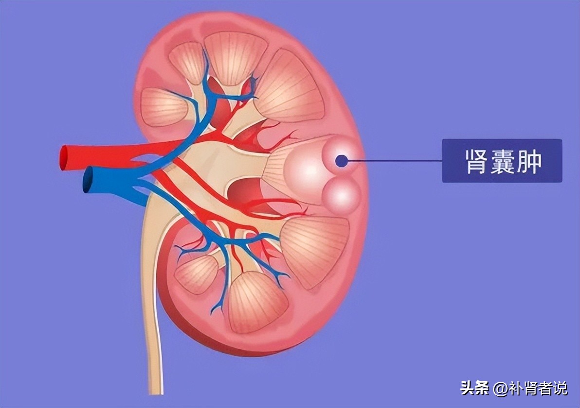 一文读懂肾小球滤过率,一文看懂骶管囊肿