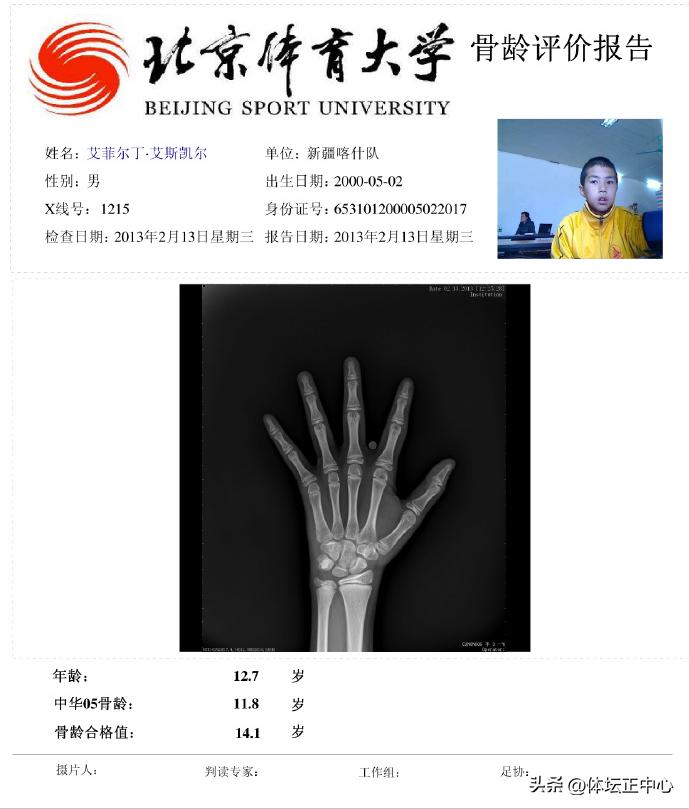 艾菲尔丁骨龄测试图出炉,艾菲尔丁改年龄是真的吗