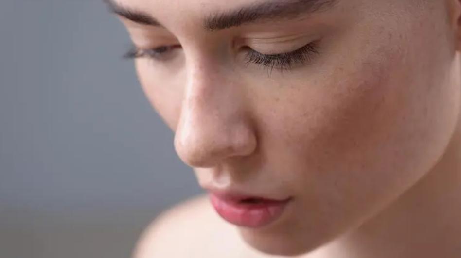 脸上爱出油是什么原因导致的,脸上长痘痘爱出油是什么原因