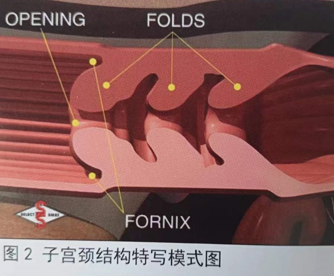 母牛的生殖生理解剖,母牛生殖器官结构及生殖生理
