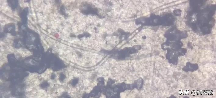 为什么抠了肚脐眼肚子会痛,为什么抠了肚脐会拉肚子