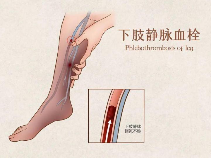 夫妻生活过程中，男人尿尿和射精会同时发生吗？医生为你解答