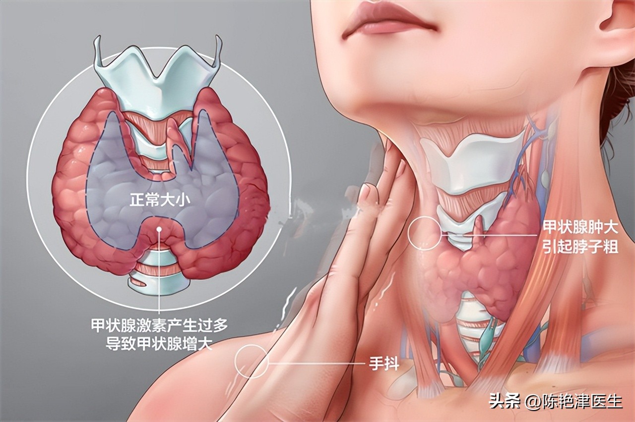 一饿就心慌头晕手抖是低血糖吗,一饿就低血糖心慌手抖怎么治疗