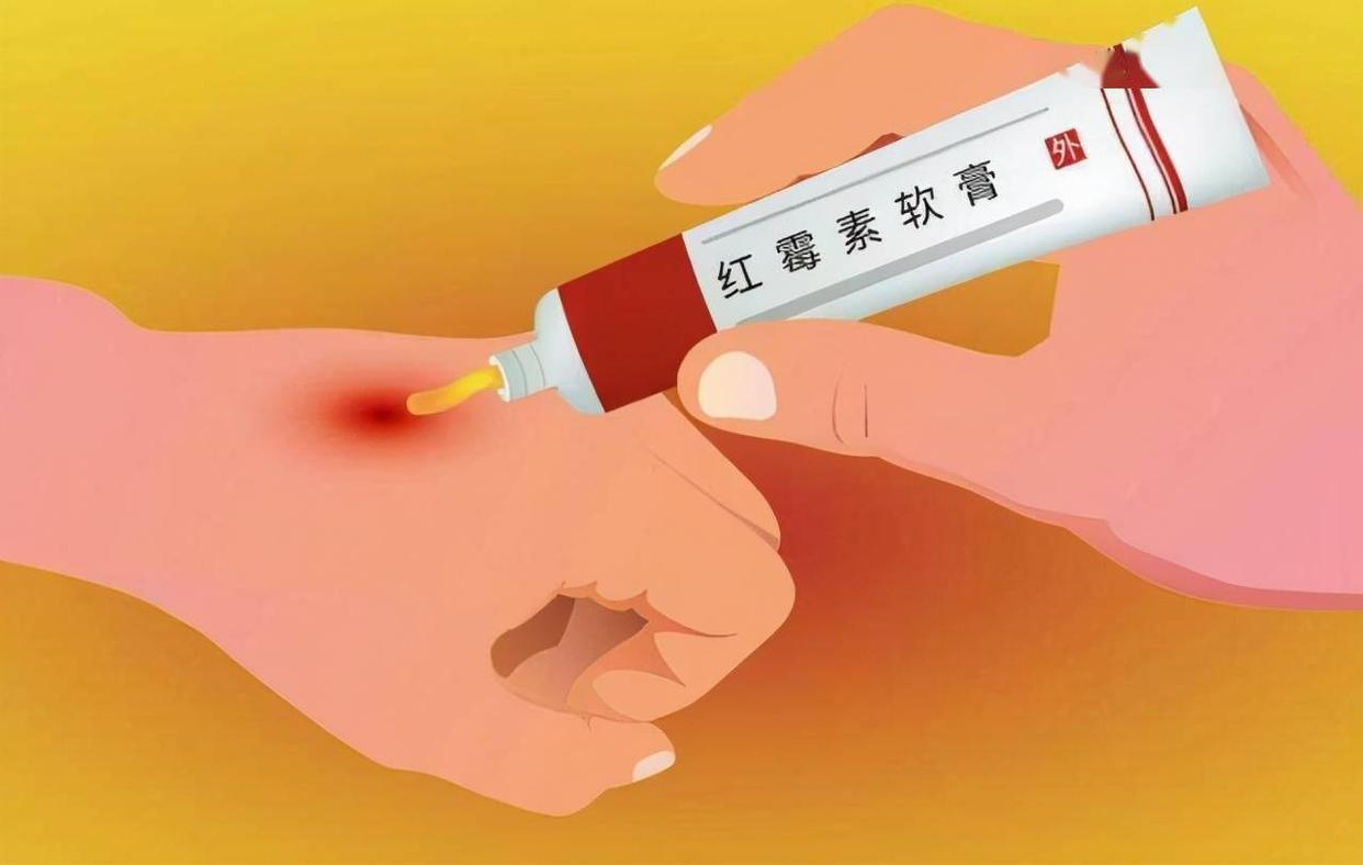 红霉素软膏抹脸上会变白吗,红霉素软膏可以擦眼下吗