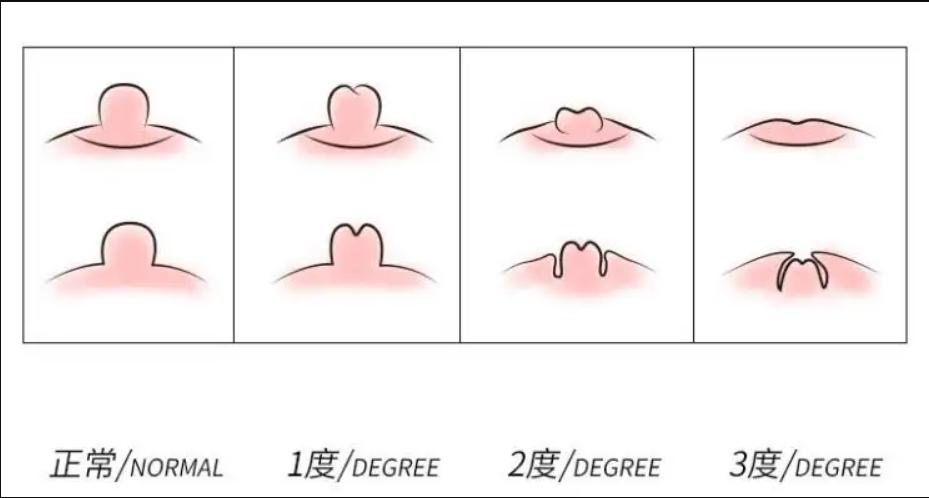 乳腺那些事儿,自发性乳腺疼痛的原因