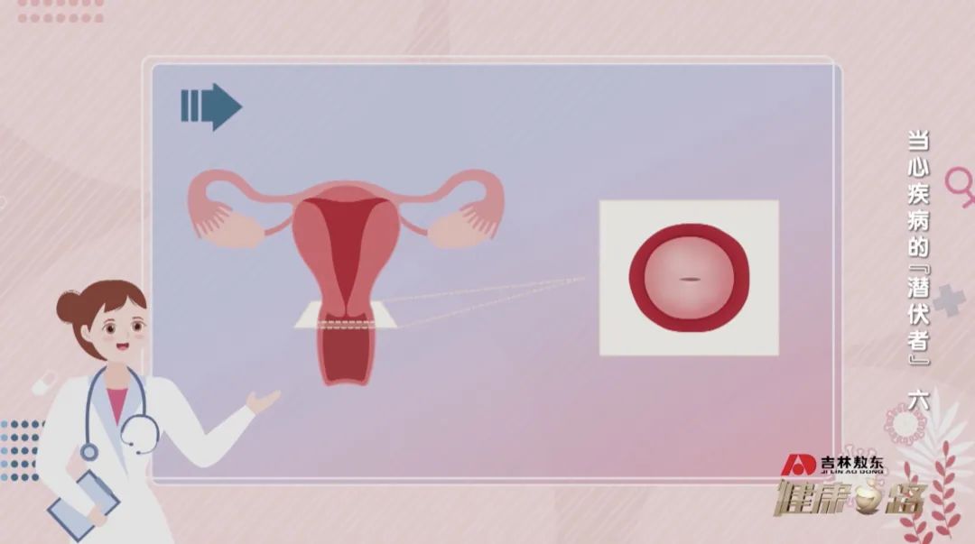 怎么读懂妇科检查报告,教你看懂妇科检查单