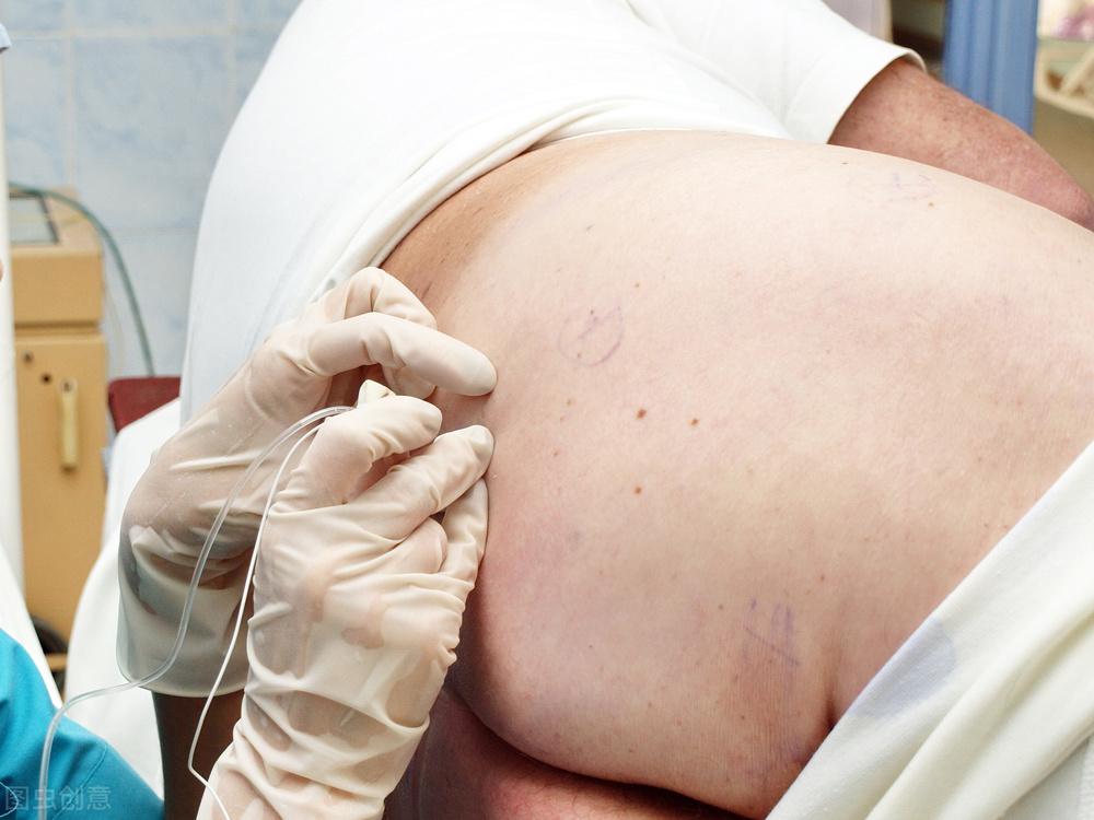 什么是麻醉过敏,什么是麻醉