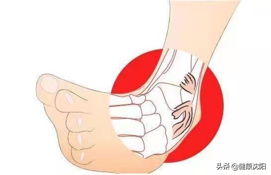 滑雪运动损伤高发怎么办,滑雪崴伤脚